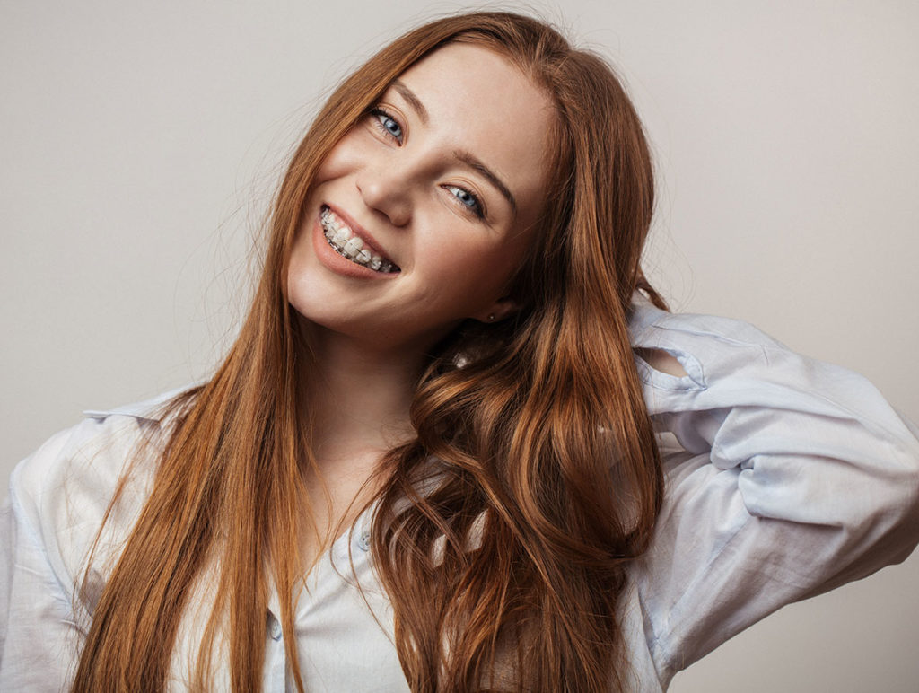 young red head woman with ceramic brackets on her teeth peoria il